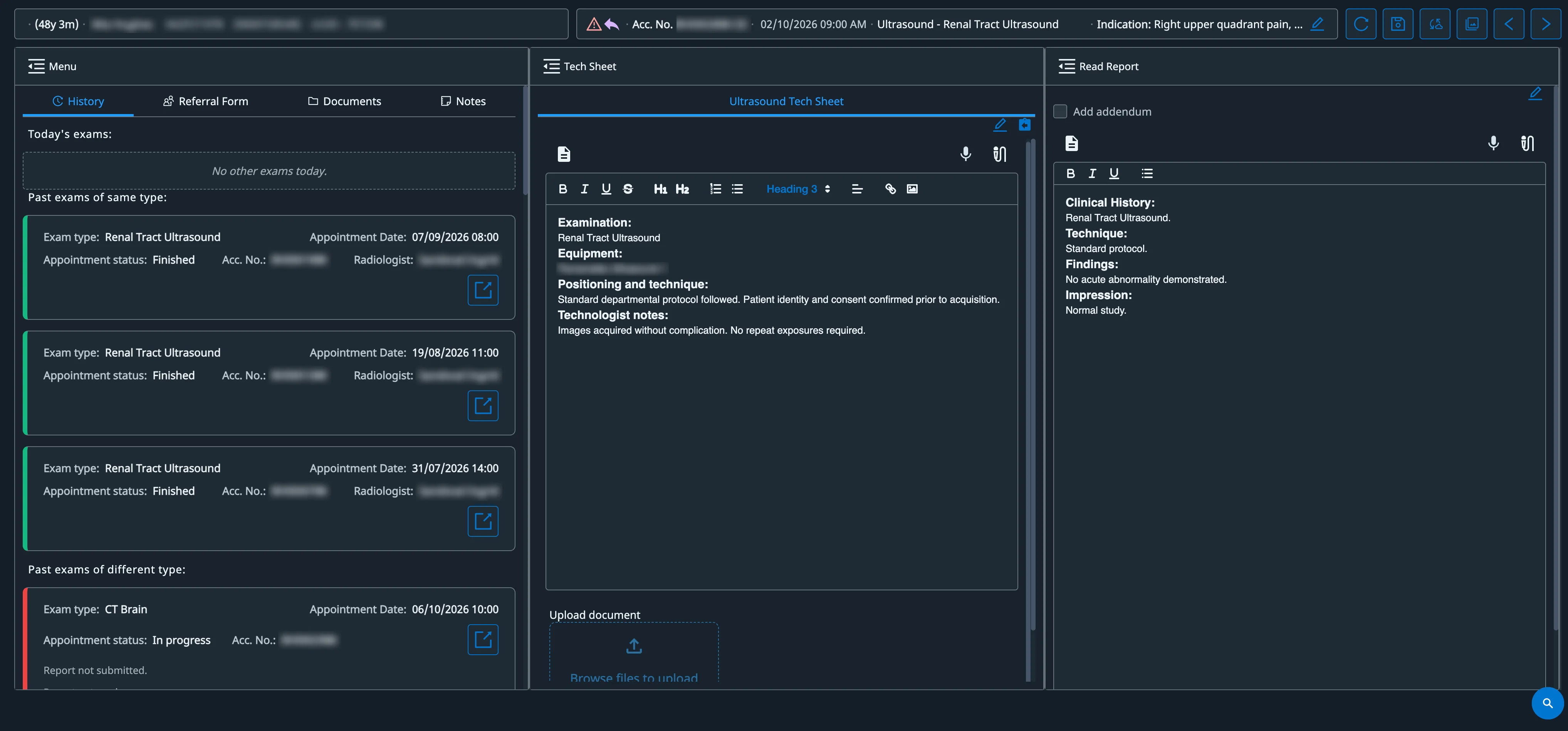 Pinga reporting workspace for a renal tract ultrasound: patient history and prior exams, the ultrasound tech sheet, and the report with dictation controls
